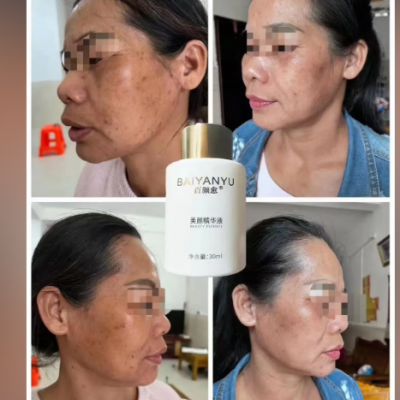 百颜愈美颜精华液化妆品加盟代理