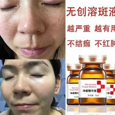 真正的绝斑疫苗源头，效果说得好不如做得好！