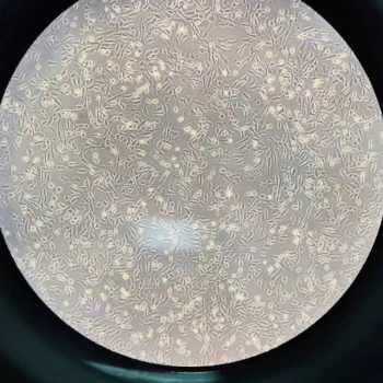 质粒载体网小鼠颈动脉内皮细胞MCEC