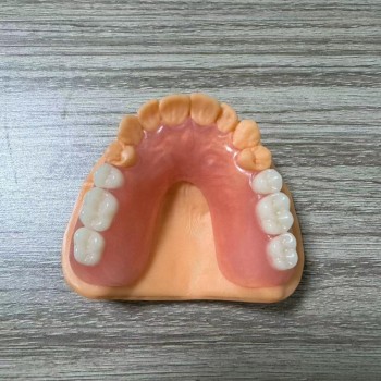 深圳国际义齿假牙牙齿活动假牙 固定假牙假牙加工厂假牙价格
